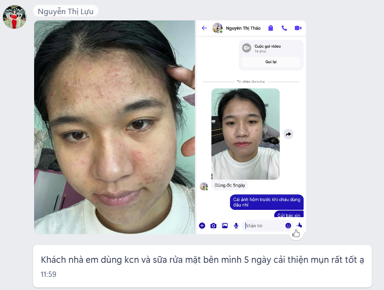 Phản hồi khách hàng về sữa rửa mặt Hoàng Sơn 4